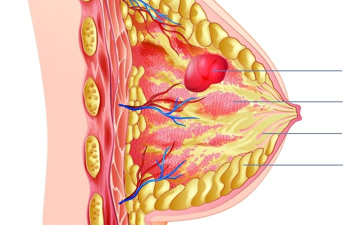 36253460 Aufbau der Brust ohne Beschreibung