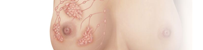 iStock 000024002185 Large